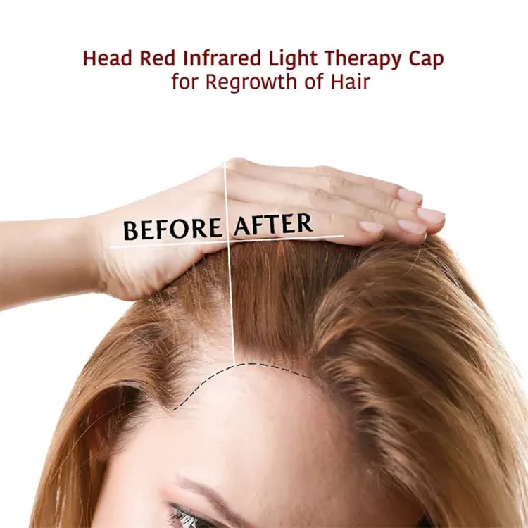 Red Light Hair Regrowth Hat