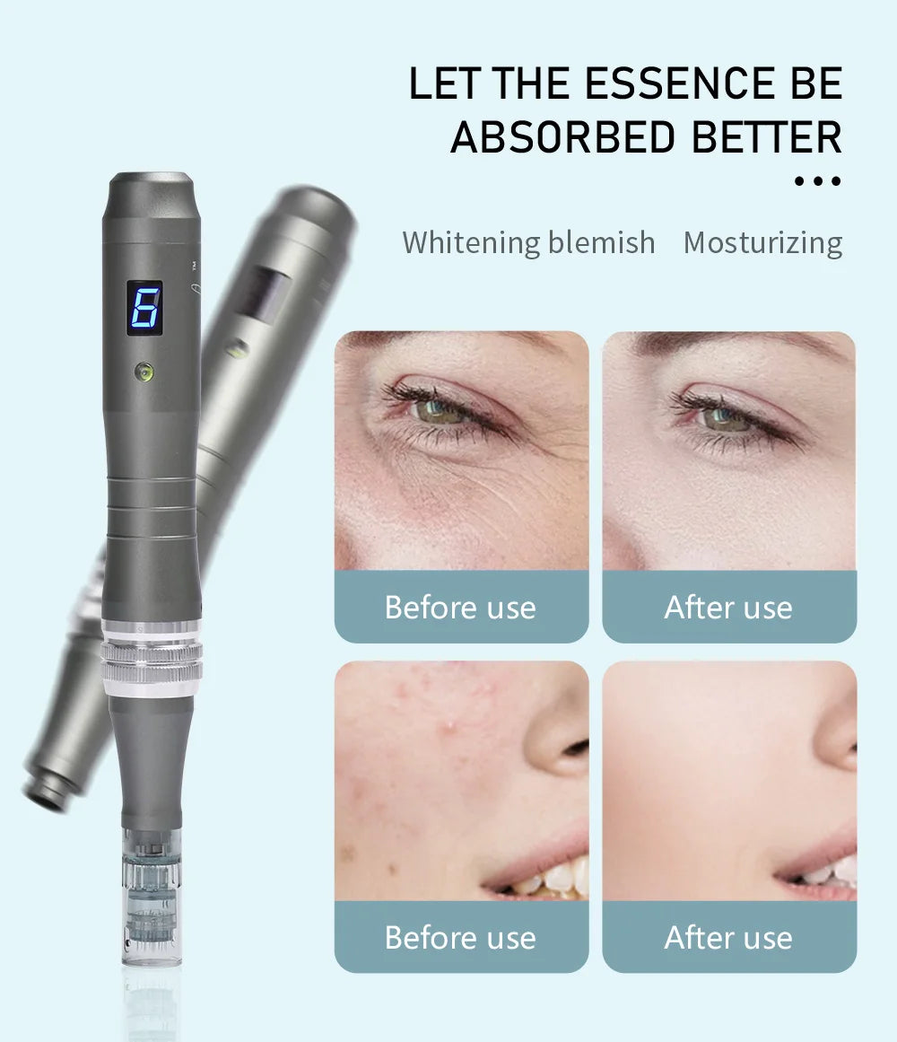 Dr Pen Microneedling Pen